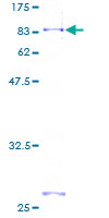 12.5% SDS-PAGE Stained with Coomassie Blue.